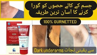 Whitening of Dark underarms  Eventone C cream uses [upl. by Ecinad795]