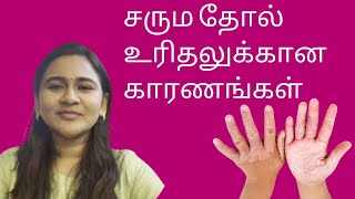 Skin Peeling தோல் உரிதல் DrGayathri Rajesh  Dermatologist  skincare  haircare [upl. by Yancey]