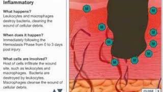 Wound Healing Process [upl. by Rosenblatt]