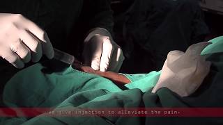 Coronary angiogram  a live demonstration [upl. by Adnohsel]