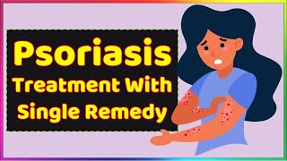 Psoriasis Homeopathic Treatment With Single Medicine [upl. by Boniface550]