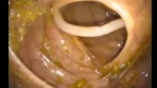 Ascaris Lumbricoides MICROBIOLOGIA Clase Mariella3 [upl. by Ailis]