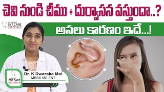 చెవి నుండి చీము  దుర్వాసన  డేంజర్ Cholesteatoma Symptoms amp Treatment  DrHarika ENT CareHospital [upl. by Langelo238]