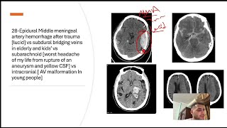 Highest yield USMLE 45 concepts in the CNS and Neuroanatomy [upl. by Anirret]