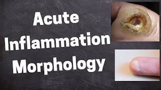 Acute Inflammation Morphology [upl. by Orpah]