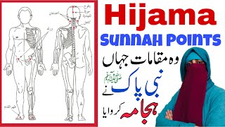 Hijama Sunnah Points  Wet Cupping  Hijama Benefits [upl. by Ayotahc]