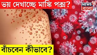 ভয় দেখাচ্ছে Monkey Pox বাঁচবেন কীভাবে । N18V [upl. by Noiwtna]