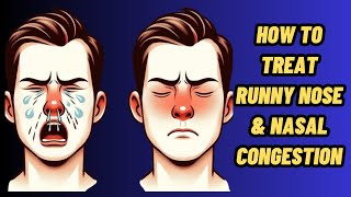 How To Stop Runny Nose  Runny Nose Home Remedy  Runny Nose Treatment [upl. by Eelarbed892]