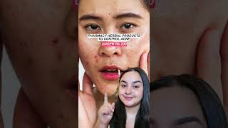 Ayurvedic creams for Acne  Affordable facedecor [upl. by Nnaerb]