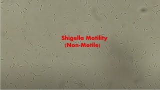 Shigella sonnei Motility [upl. by Eisdnyl]