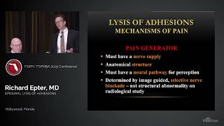 Dr Richard Epter Epidurolysis of Adhesions [upl. by Aiveneg]