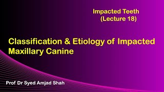 Classification amp Etiology of Impacted Canine  Oral amp Maxillofacial Surgery  Syed Amjad Shah [upl. by Erimahs847]