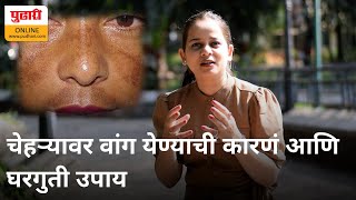 चेहऱ्यावर वांग येण्याची कारणे आणि घरगुती उपाय  Causes of pigmentation and home remedies [upl. by Ainslee]