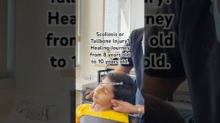 Scoliosis or Tailbone Injury Healing Journey from 8 years old to 10 years old chiropractor [upl. by Aekerly]