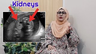 how to know gender of baby on ultrasound  pyelectasis of fetus shows baby boy  gender reveal scan [upl. by Yanetruoc]