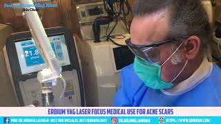 Get Clear Skin Erbium Yag Lasers Breakthrough Acne Scars Treatment acnetreatment lasertreatment [upl. by Rephotsirhc52]