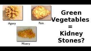 Do Oxalates Cause Kidney Stones And Rob You Of Calcium [upl. by Noram]