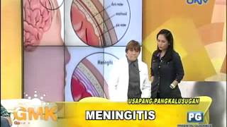 What is Meningitis [upl. by Stempson]