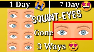 Squint Eye correction NATURALLY with exercises at Home [upl. by Fadden]