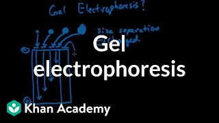 Gel electrophoresis [upl. by Haerr599]