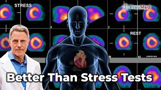 The Truth About Nuclear Stress Tests [upl. by Arraek580]