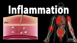 Inflammatory Response Animation [upl. by Rdnaskela]