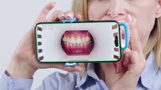 Invisalign Virtual Care [upl. by Dworman]