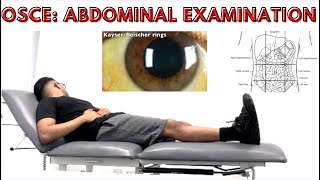 OSCE Abdominal Examination [upl. by Clite]