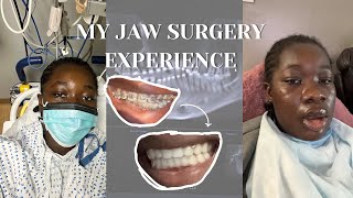 WHY I GOT JAW SURGERY AT 22  CORRECTIVE JAW SURGERY [upl. by Akemaj]