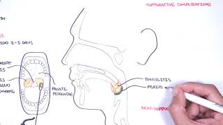 What Causes Strep Throat [upl. by Llenrep]