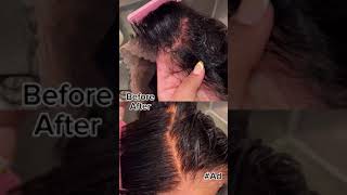 Undetectable wigs are easy with this expert wig knot lightening tutorial BW2plus wigs ClairolPro [upl. by Briano779]