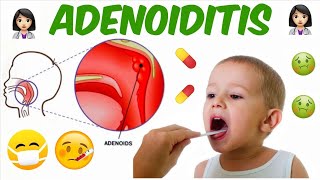 PharyngoTonsillitis and Adenoiditis  Part 2  ENT [upl. by Llenrag]