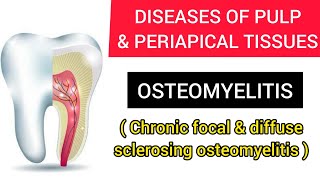 OSTEOMYELITIS CHRONIC FOCAL AND DIFFUSE SCLEROSING OSTEOMYELITIS [upl. by Babbie]