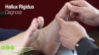 Hallux Rigidus Causes Diagnosis and Treatment [upl. by Ennaxor]