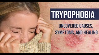 Trypophobia  Uncovered Causes Symptoms and Healing [upl. by Niar]