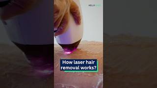 How laser hair removal works [upl. by Spohr]