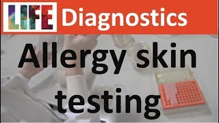 Allergy skin testing [upl. by Eerehc101]