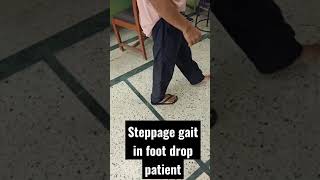 What is Steppage gait in foot drop patient  What is foot drop gait  high steppage gait [upl. by Ade]