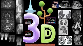 TOP THREE DIFFERENTIAL DIAGNOSIS SET II [upl. by Sihon514]