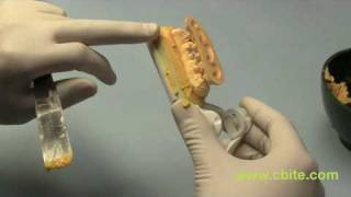 Dental Articulators Spin NEO  SingleBite Method 8 of 11 videos [upl. by Isaiah]