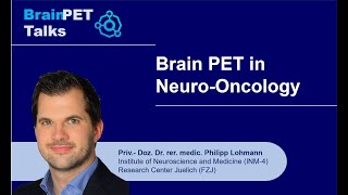 Dr Lohmann Neuro Oncology [upl. by Marilla172]