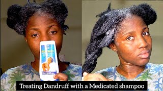 How to apply medicated antidandruff shampoo with ketoconazole on Natural Hair [upl. by Andreana]