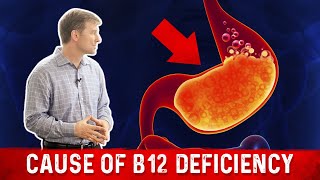 Vitamin B12 Deficiency The most common Cause – Dr Berg [upl. by Tremann181]