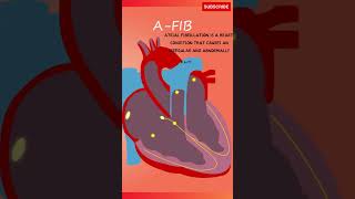 Atrial Fibrillation Sound  Heartbeat Sound and Explanation heartbeat atrialfibrillation [upl. by Refinej538]