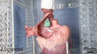 A multifunctional soft robot for cardiac interventions demonstration of deployment [upl. by Aelegna609]