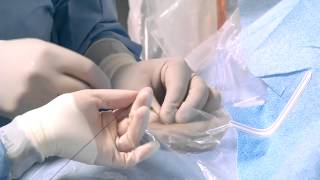 Transradial Cardiac Catheterization [upl. by Ayenat]