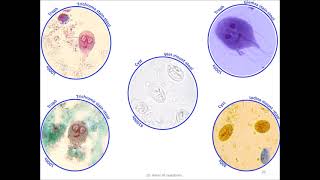 Giardia lamblia Giardia intestinalis Giardia doudenalis [upl. by Ronn312]