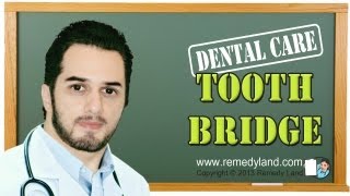 Tooth bridge or dental bridge  Fixed Maryland Cantilever Nesbit Temporary [upl. by Kirwin887]