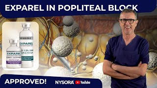 Popliteal block Exparel®s GameChanging FDA Approval [upl. by Yennor]