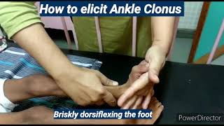 Ankle Clonus I Pediatrics [upl. by Atiruam]